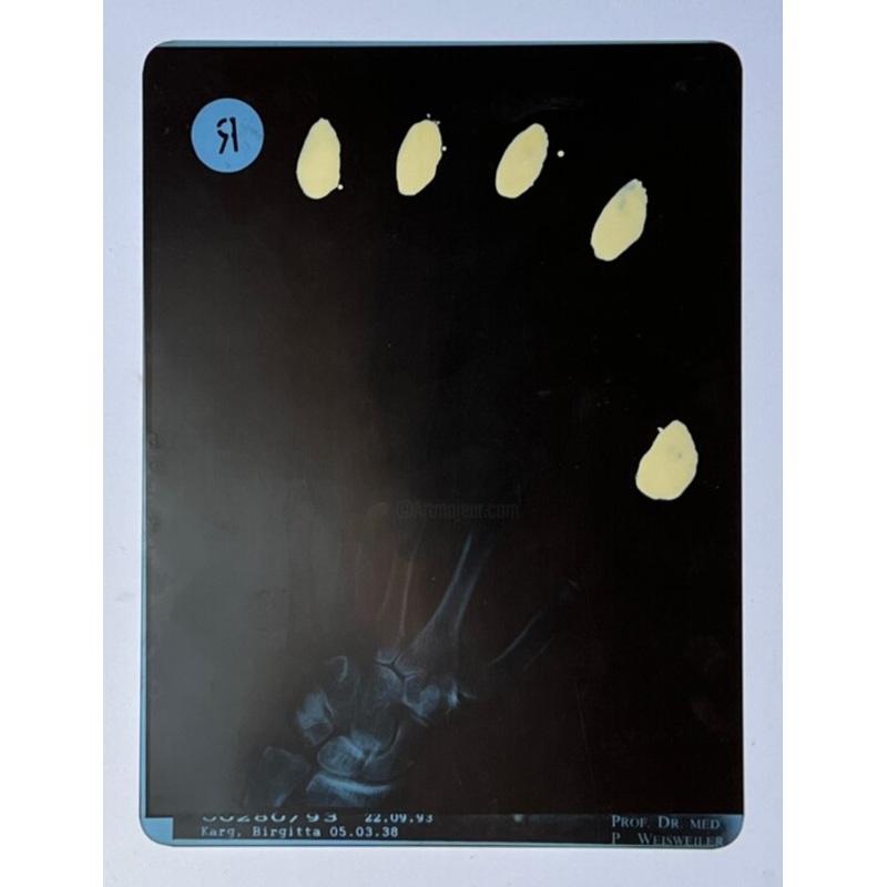 X-Ray 1 Painting by Birgit Karg | ArtMajeur